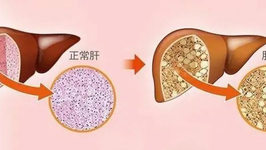 网友想要懒人洗衣机 海尔：连夜开发,新澳门彩最新开奖结果,精准解释落实及其象征意义_高级版V6.11